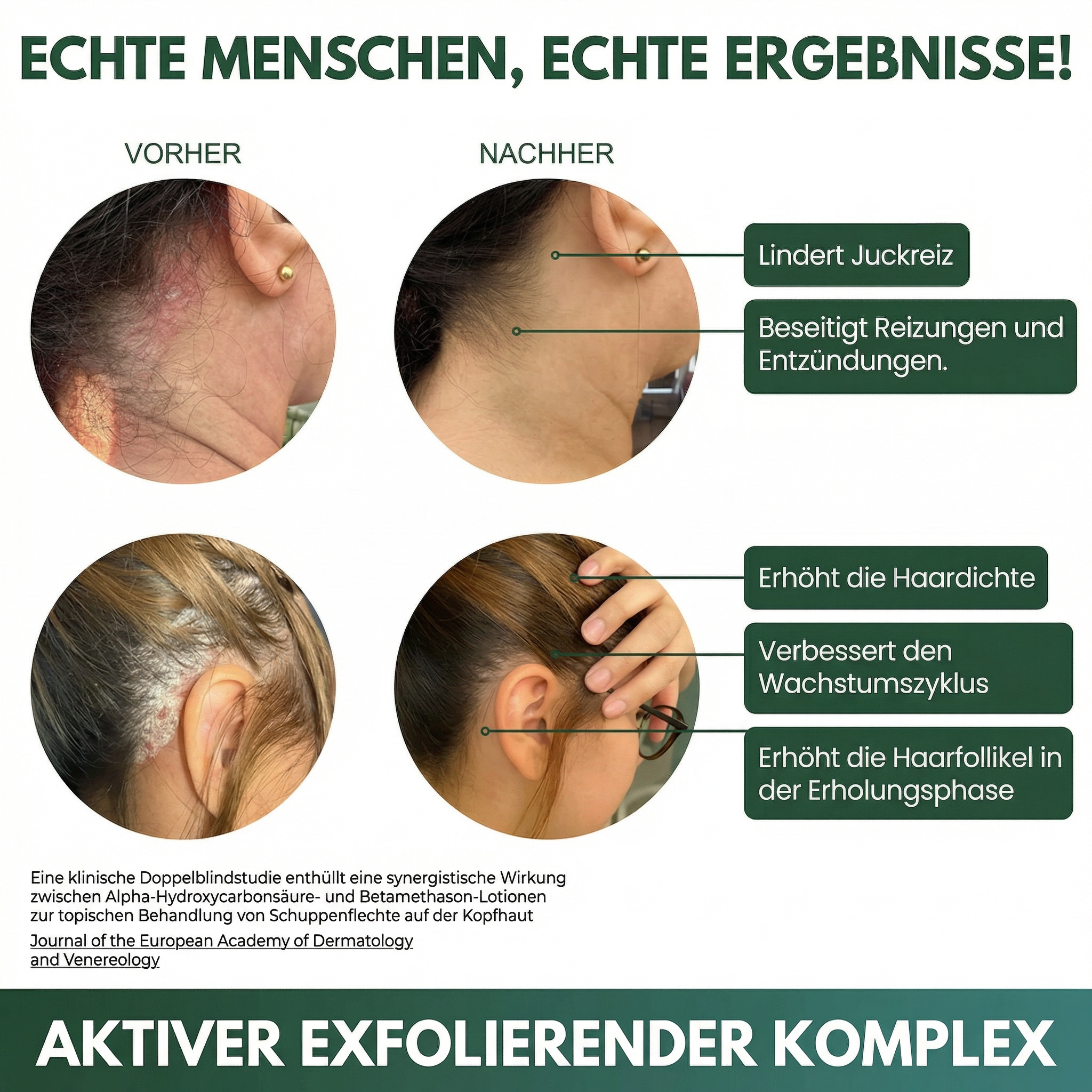 LISSIMA Natürliches Kopfhautpeeling – bei schuppiger, juckender und gereizter Kopfhaut